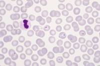 Plasmodium falciparum - agent du paludisme x400